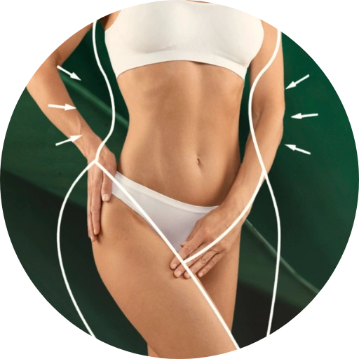 Ceník Kest estetic, I-MODEL – Neinvazivní formování těla